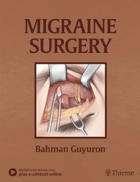 Guyuron | Migraine Surgery | Medienkombination | 978-1-62623-692-9 | sack.de