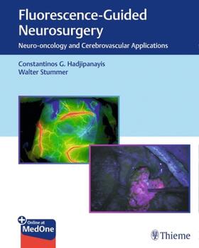 Hadjipanayis / Stummer | Hadjipanayis, C: Fluorescence-Guided Neurosurgery | Medienkombination | sack.de