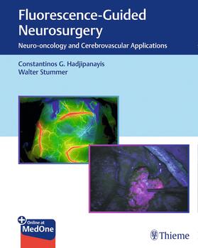 Hadjipanayis / Stummer | Fluorescence-Guided Neurosurgery | E-Book | sack.de