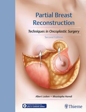 Losken / Hamdi | Partial Breast Reconstruction | E-Book | sack.de