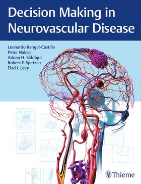 Rangel-Castilla / Nakaji / Siddiqui |  Decision Making in Neurovascular Disease | eBook | Sack Fachmedien