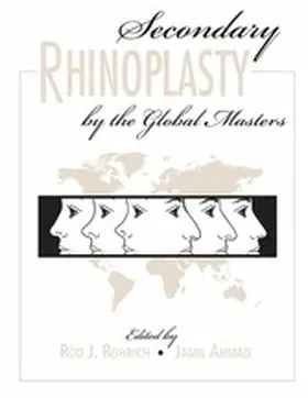 Rohrich / Ahmad |  Secondary Rhinoplasty by the Global Masters | eBook | Sack Fachmedien