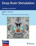 Anderson |  Deep Brain Stimulation | Buch |  Sack Fachmedien