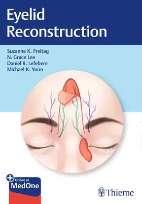 Freitag / Lee / Lefebvre |  Eyelid Reconstruction | eBook | Sack Fachmedien