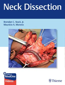 Stack, Jr. / Stack / Jr. |  Neck Dissection | eBook | Sack Fachmedien