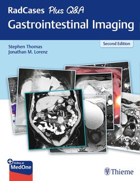 Thomas / Lorenz | RadCases Plus Q&A Gastrointestinal Imaging | Buch | 978-1-62623-868-8 | sack.de
