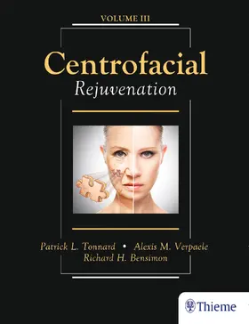 Tonnard / Verpaele / Bensimon | Centrofacial Rejuvenation | E-Book | www.sack.de