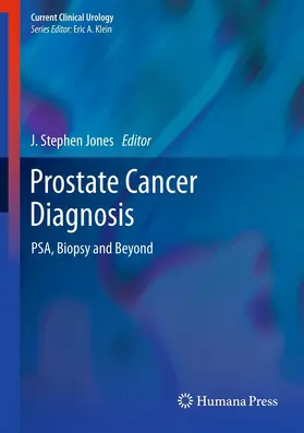 Jones | Prostate Cancer Diagnosis | E-Book | www.sack.de