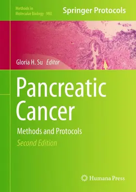 Su | Pancreatic Cancer | Buch | 978-1-62703-286-5 | www.sack.de