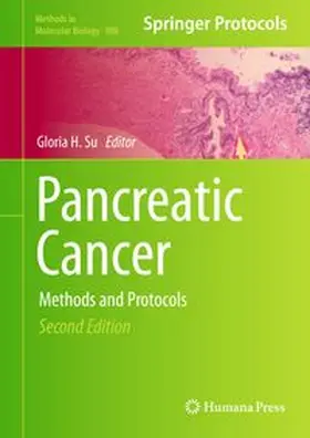 Su |  Pancreatic Cancer | eBook | Sack Fachmedien