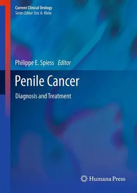 Spiess | Penile Cancer | Buch | 978-1-62703-366-4 | sack.de