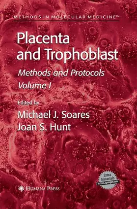 Hunt / Soares |  Placenta and Trophoblast | Buch |  Sack Fachmedien