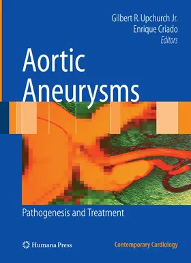 Upchurch Jr. / Criado | Aortic Aneurysms | Buch | 978-1-62703-929-1 | www.sack.de
