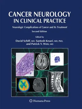 Schiff / Wen / Kesari |  Cancer Neurology in Clinical Practice | Buch |  Sack Fachmedien