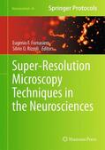 Rizzoli / Fornasiero |  Super-Resolution Microscopy Techniques in the Neurosciences | Buch |  Sack Fachmedien