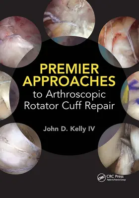 Kelly |  Premier Approaches to Arthroscopic Rotator Cuff Repair | Buch |  Sack Fachmedien