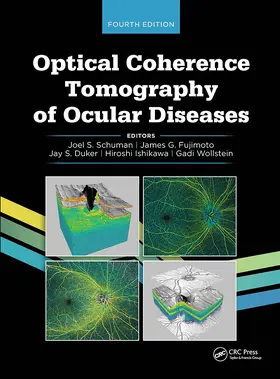 Schuman / Fujimoto / Duker |  Optical Coherence Tomography of Ocular Diseases | Buch |  Sack Fachmedien