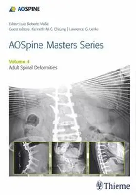 Lenke / Cheung | AOSpine Masters Series, Volume 4: Adult Spinal Deformities | E-Book | www.sack.de