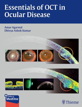 Agarwal / Kumar | Essentials of OCT in Ocular Disease | E-Book | sack.de