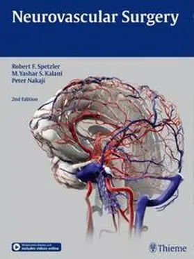 Spetzler / Kalani / Nakaji | Neurovascular Surgery | E-Book | www.sack.de