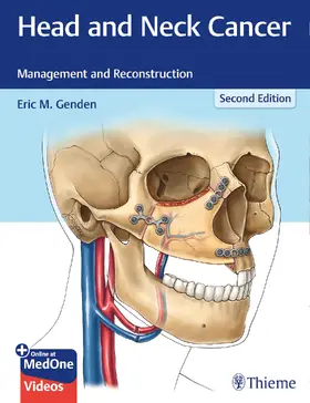 Genden | Head and Neck Cancer | E-Book | sack.de