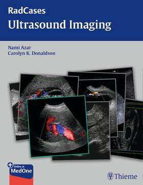 Azar / Donaldson | Radcases Ultrasound Imaging | E-Book | sack.de