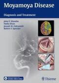Wanebo / Khan / Zabramski |  Moyamoya Disease | eBook | Sack Fachmedien
