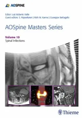 Rajasekaran / Vialle / Kanna |  AOSpine Masters Series, Volume 10: Spinal Infections | eBook | Sack Fachmedien