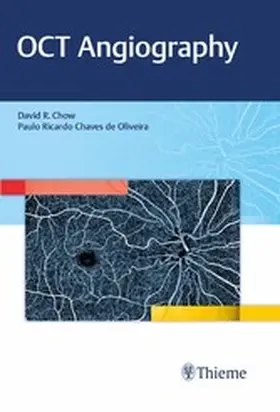 Chow |  OCT Angiography | eBook | Sack Fachmedien