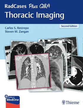 Restrepo / Zangan |  RadCases Plus Q&A Thoracic Imaging | eBook | Sack Fachmedien