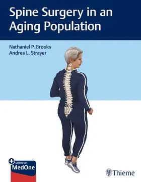 Brooks / Strayer |  Spine Surgery in an Aging Population | eBook | Sack Fachmedien