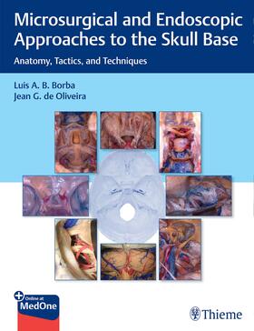 Borba / de Oliveira | Microsurgical and Endoscopic Approaches to the Skull Base | E-Book | sack.de