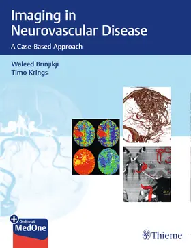 Brinjikji / Krings | Imaging in Neurovascular Disease | E-Book | www.sack.de