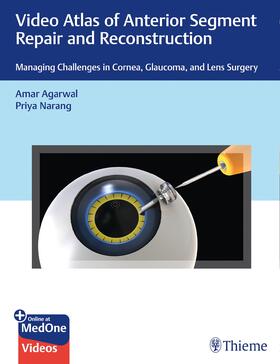Agarwal / Narang | Video Atlas of Anterior Segment Repair and Reconstruction | E-Book | sack.de