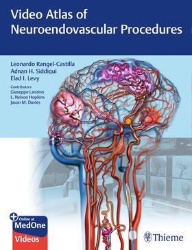Rangel-Castilla / Siddiqui / Levy |  Video Atlas of Neuroendovascular Procedures | eBook | Sack Fachmedien