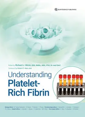 Miron |  Understanding Platelet-Rich Fibrin | Buch |  Sack Fachmedien