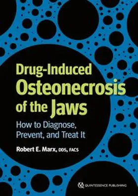 Marx |  Drug-Induced Osteonecrosis of the Jaws | Buch |  Sack Fachmedien
