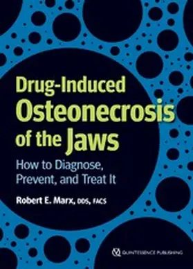 Marx |  Drug-Induced Osteonecrosis of the Jaws | eBook | Sack Fachmedien