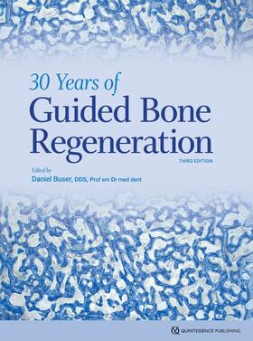 Buser | 30 Years of Guided Bone Regeneration | E-Book | sack.de
