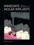 Deporter / Ketabi |  Immediate Molar Implants | eBook | Sack Fachmedien