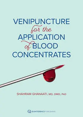 Ghanaati |  Venipuncture for the Application of Blood Concentrates | Buch |  Sack Fachmedien
