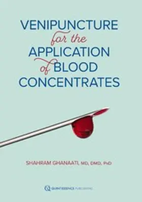 Ghanaati |  Venipuncture for the Application of Blood Concentrates | eBook | Sack Fachmedien