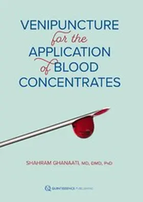 Ghanaati |  Venipuncture for the Application of Blood Concentrates | eBook | Sack Fachmedien