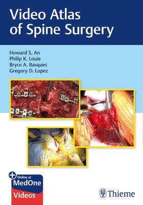 An / Louie / Basques | Video Atlas of Spine Surgery | E-Book | sack.de