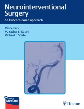Park / Kalani / Stiefel |  Neurointerventional Surgery | Buch |  Sack Fachmedien