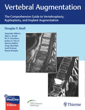Beall | Vertebral Augmentation | E-Book | www.sack.de