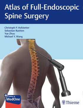 Hofstetter / Ruetten / Zhou | Atlas of Full-Endoscopic Spine Surgery | E-Book | sack.de