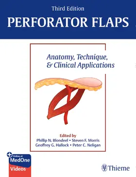 Blondeel / Morris / Hallock |  Perforator Flaps | Buch |  Sack Fachmedien