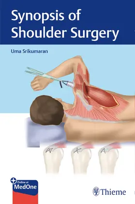 Srikumaran | Synopsis of Shoulder Surgery | E-Book | www.sack.de