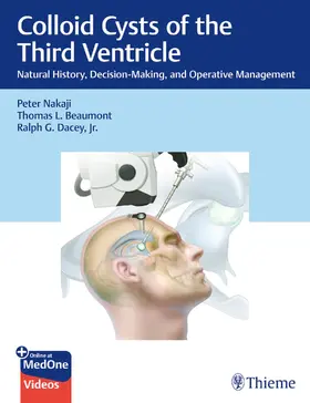 Nakaji / Beaumont / Dacey, Jr. | Colloid Cysts of the Third Ventricle | E-Book | www.sack.de